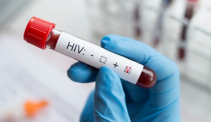 National HIV Testing Day