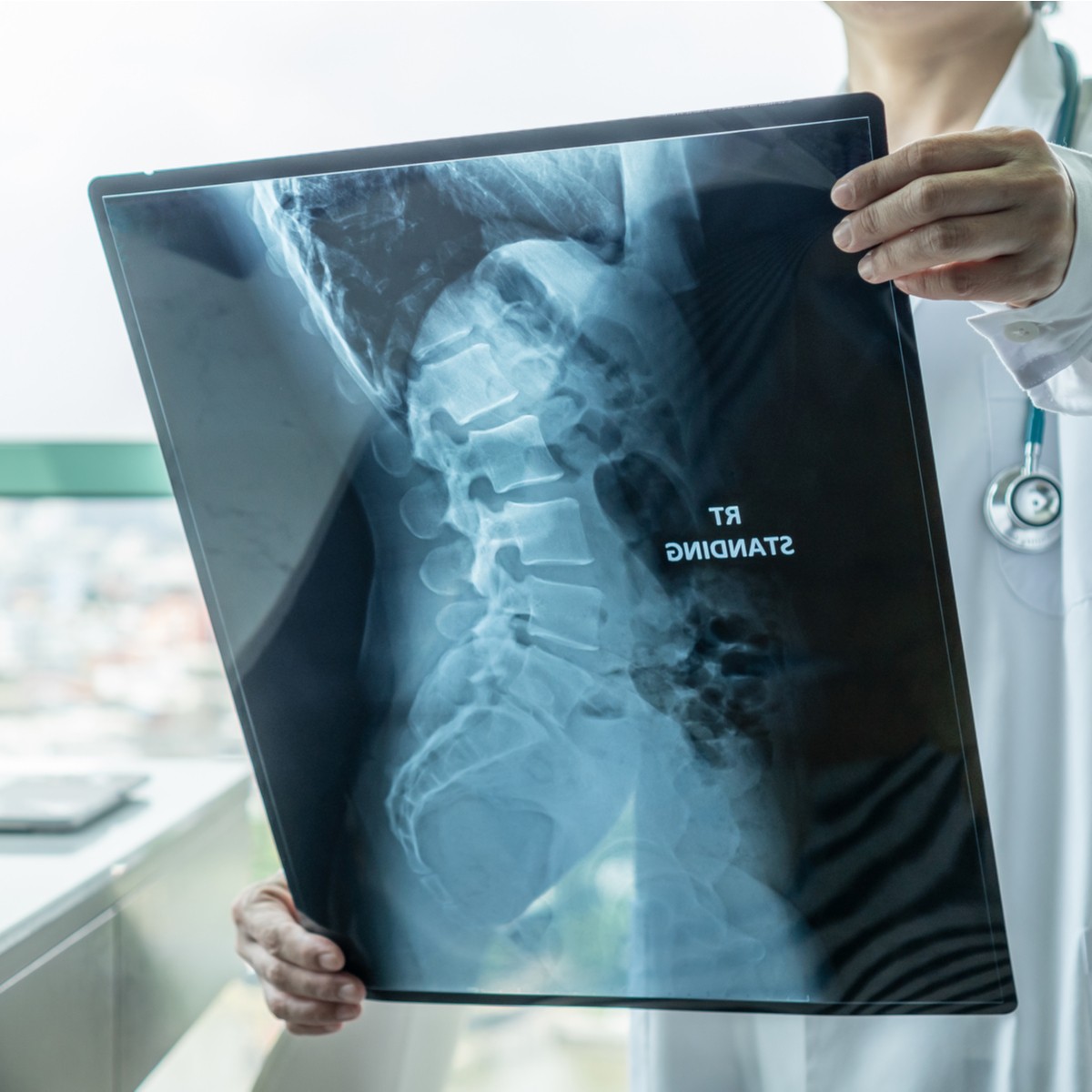 World-Spine-Day