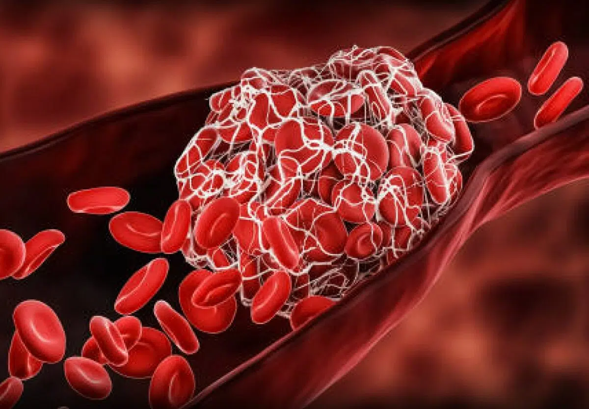 World Thrombosis Day